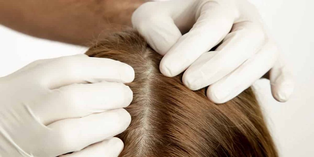 Additional Tips and Advice