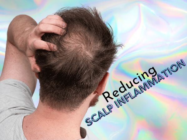 Reducing Scalp Inflammation Reducing Scalp Inflammation