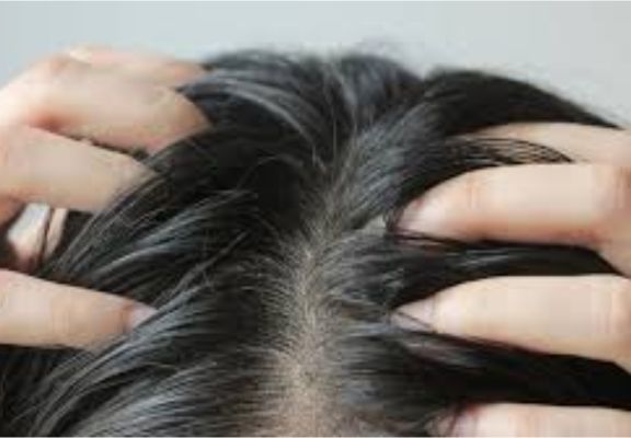 Scalp Irritation and Allergy Scalp Irritation and Allergy