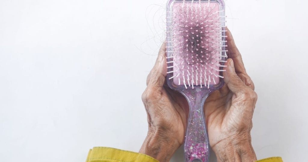 Hair strands on a brush, a common hair fall worry